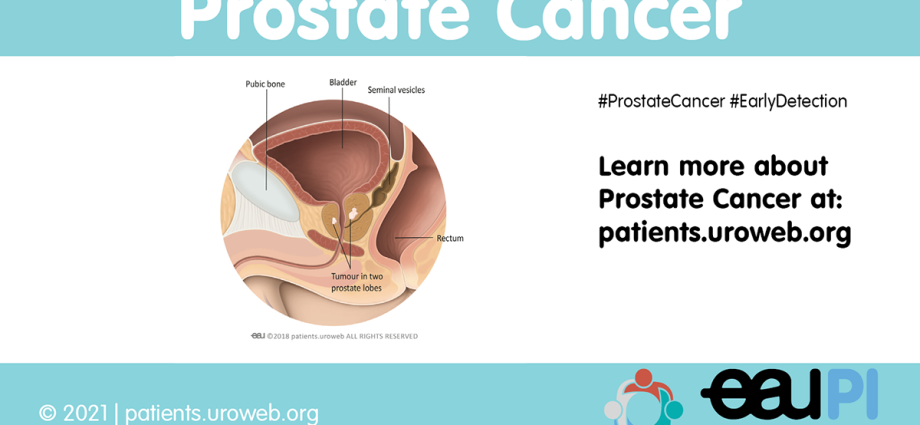 Prostate cancer faq, or what you need to know but are afraid to ask &#8230;