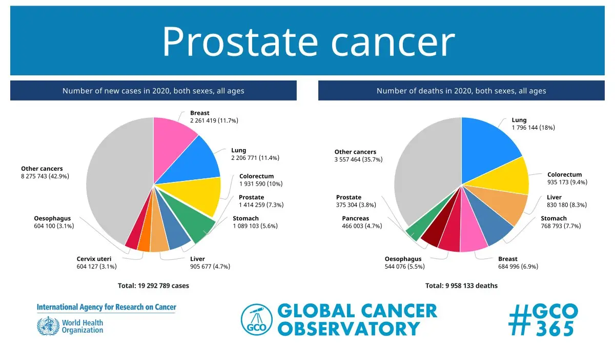 Prostate cancer is the most commonly diagnosed cancer in men. Disturbing data