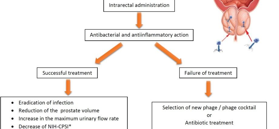 Prostatitis &#8211; symptoms, treatment