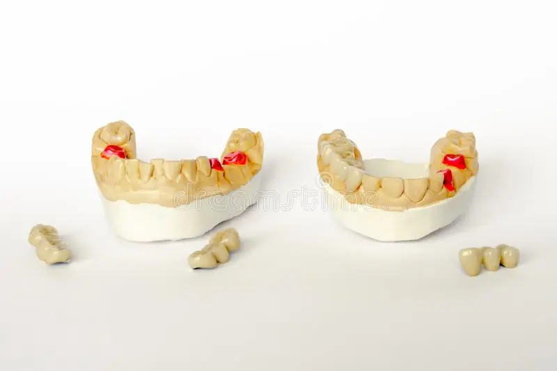 Prosthetics &#8211; generally and in detail. Dental, orthopedic and aesthetic prosthetics