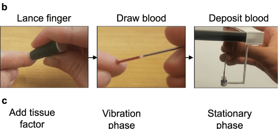 Prothrombin time, which is how fast blood clots