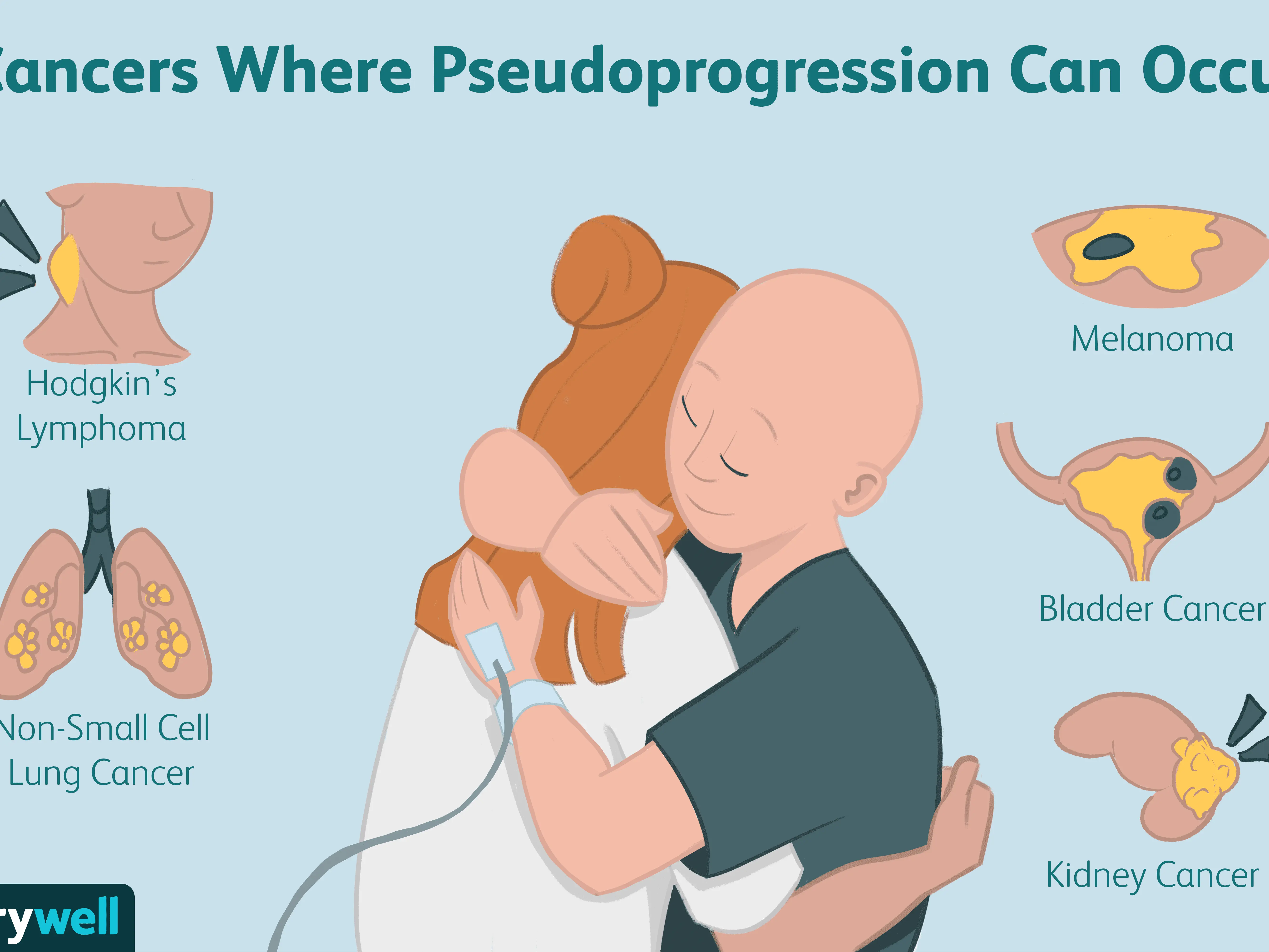 Pseudo-tumors &#8211; what is it, causes, treatment