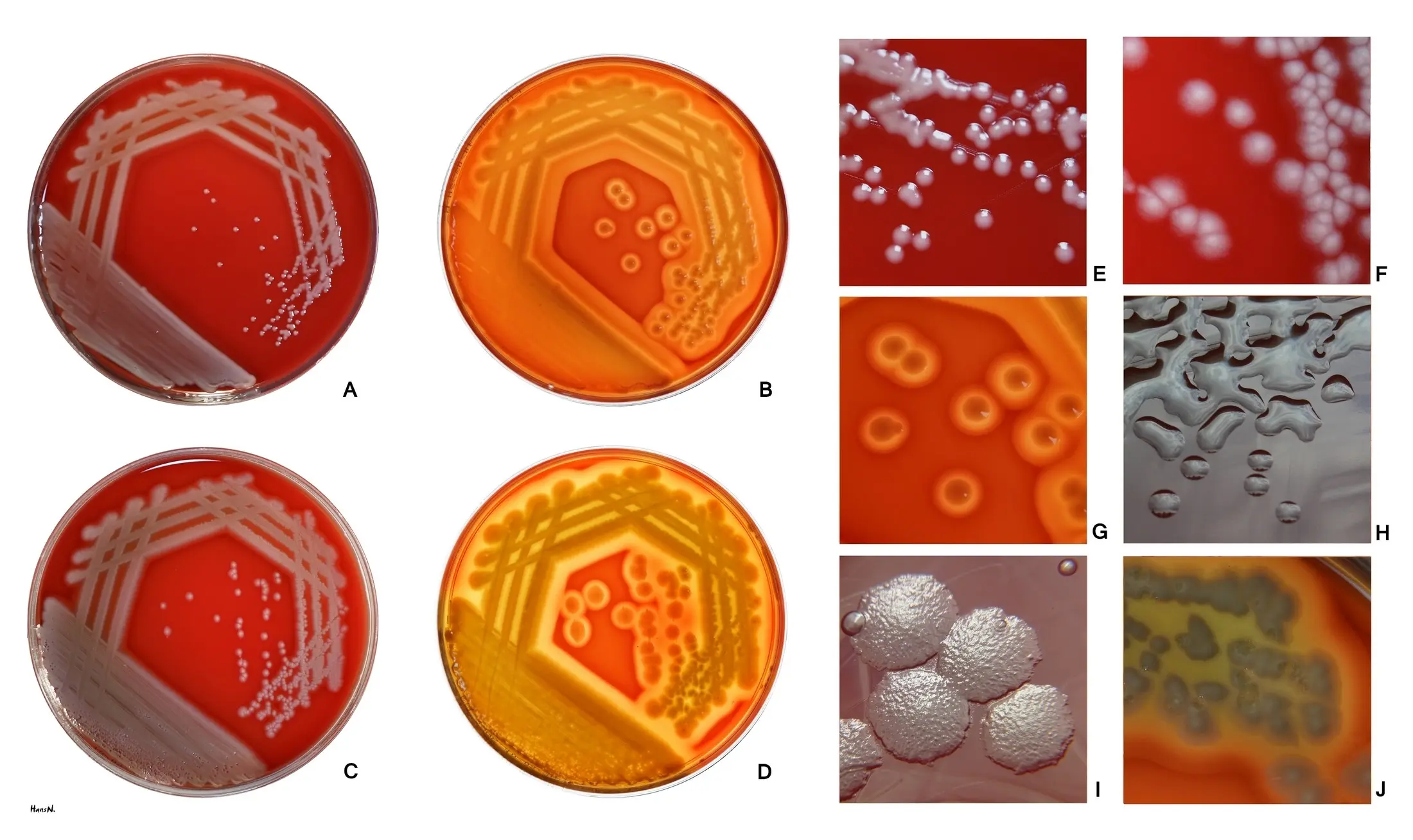 Pseudomonas aeruginosa &#8211; symptoms, diagnosis and treatment of blue pus bacillus infection