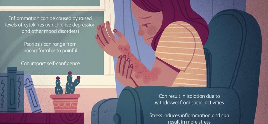 Psoriasis increases the risk of depression, anxiety and suicidal thoughts