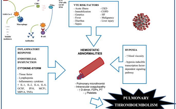 Pulmonary embolism in COVID-19 &#8211; a side effect of the coronavirus