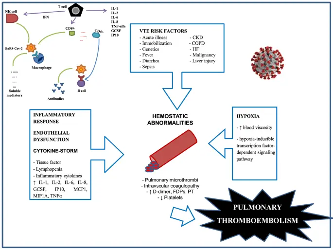 Pulmonary embolism in COVID-19 &#8211; a side effect of the coronavirus