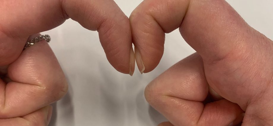 Put two fingers together. A simple test can reveal heart disease, liver disease, and lung cancer