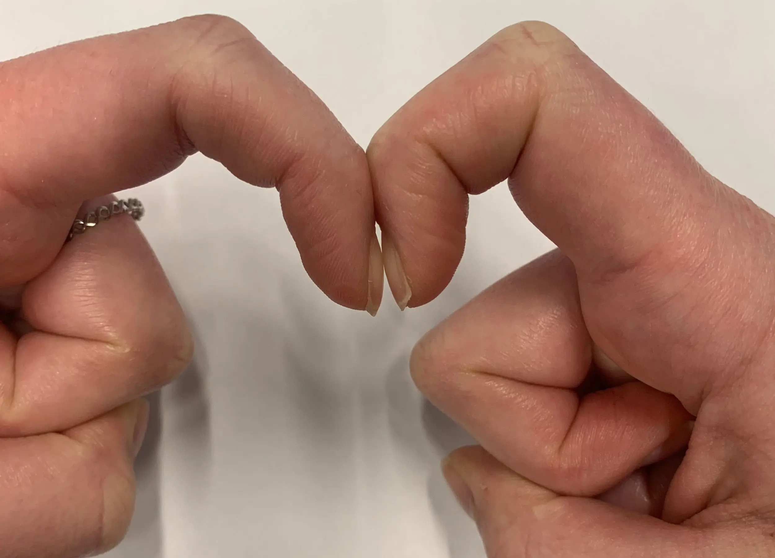 Put two fingers together. A simple test can reveal heart disease, liver disease, and lung cancer