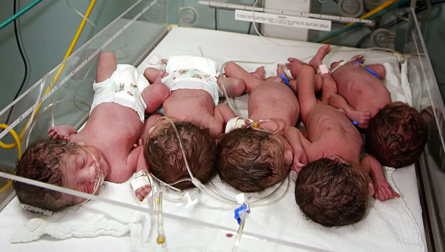 Quintuplets are born once in 52 million births. What is conducive to multiple pregnancy and how does it happen?