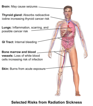 Radiation sickness &#8211; symptoms. What is the treatment of acute radiation sickness?