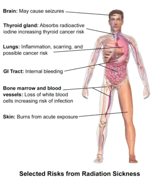 Radiation sickness &#8211; symptoms. What is the treatment of acute radiation sickness?