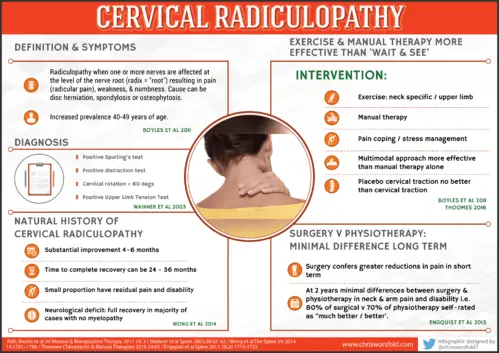 Radiculopathy &#8211; symptoms, diagnosis, treatment