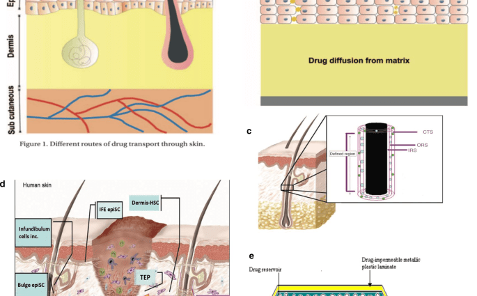 Radio waves for slimming &#8211; action, contraindications, effects