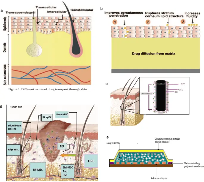 Radio waves for slimming &#8211; action, contraindications, effects