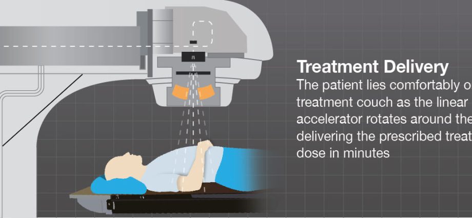 Radiotherapy &#8211; types, preparation, course. Side effects of radiation therapy