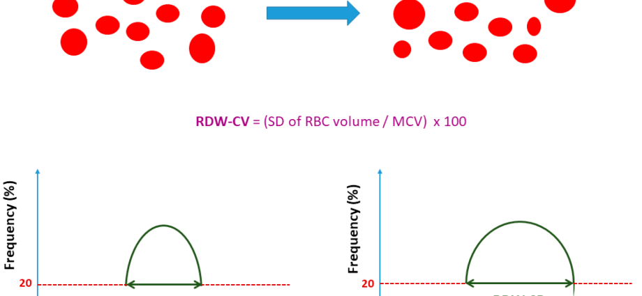 RDW-CV – standarde. Ce înseamnă RDW-CV crescut și scăzut? Noi explicam