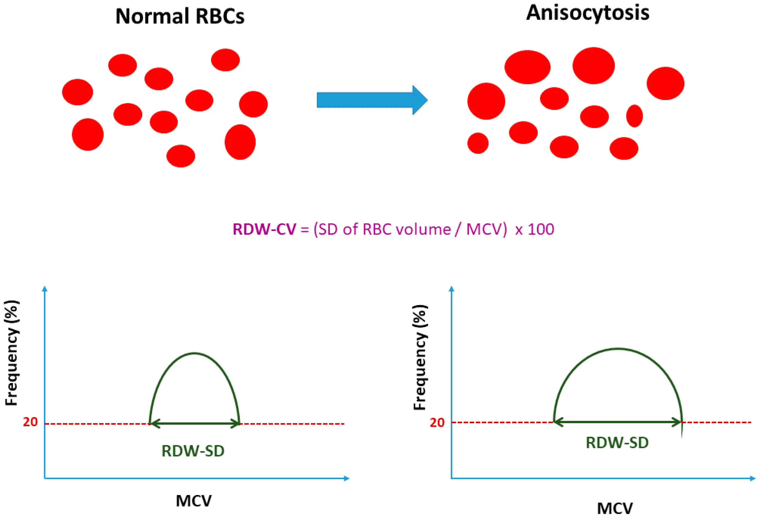 RDW-CV &#8211; standards. What does elevated and lowered RDW-CV mean? We explain