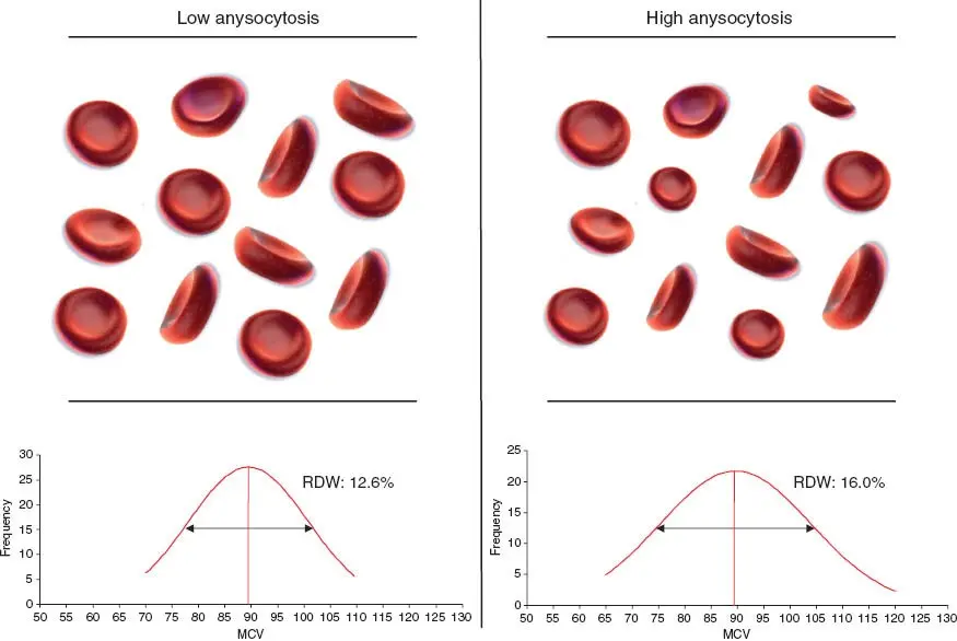 RDW &#8211; norm, blood count, blood test, red blood cells. What is the volume distribution range of red blood cells?