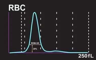 RDW-SD &#8211; determination, indications, standard, analysis of results