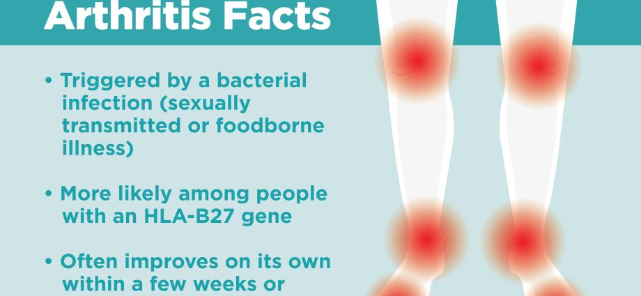 Reactive arthritis associated with sexually transmitted diseases