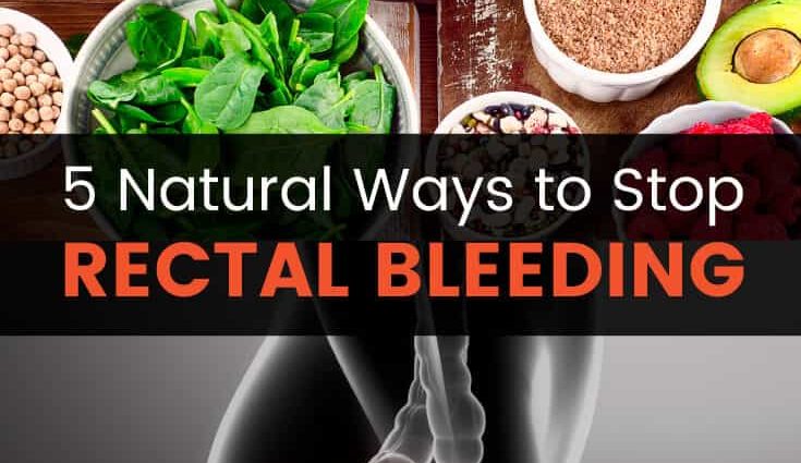 Rectal bleeding &#8211; causes, diagnosis, treatment. What to do in case of bleeding?