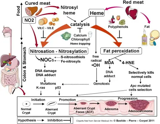 Red meat and colon cancer. The latest research leaves no doubt