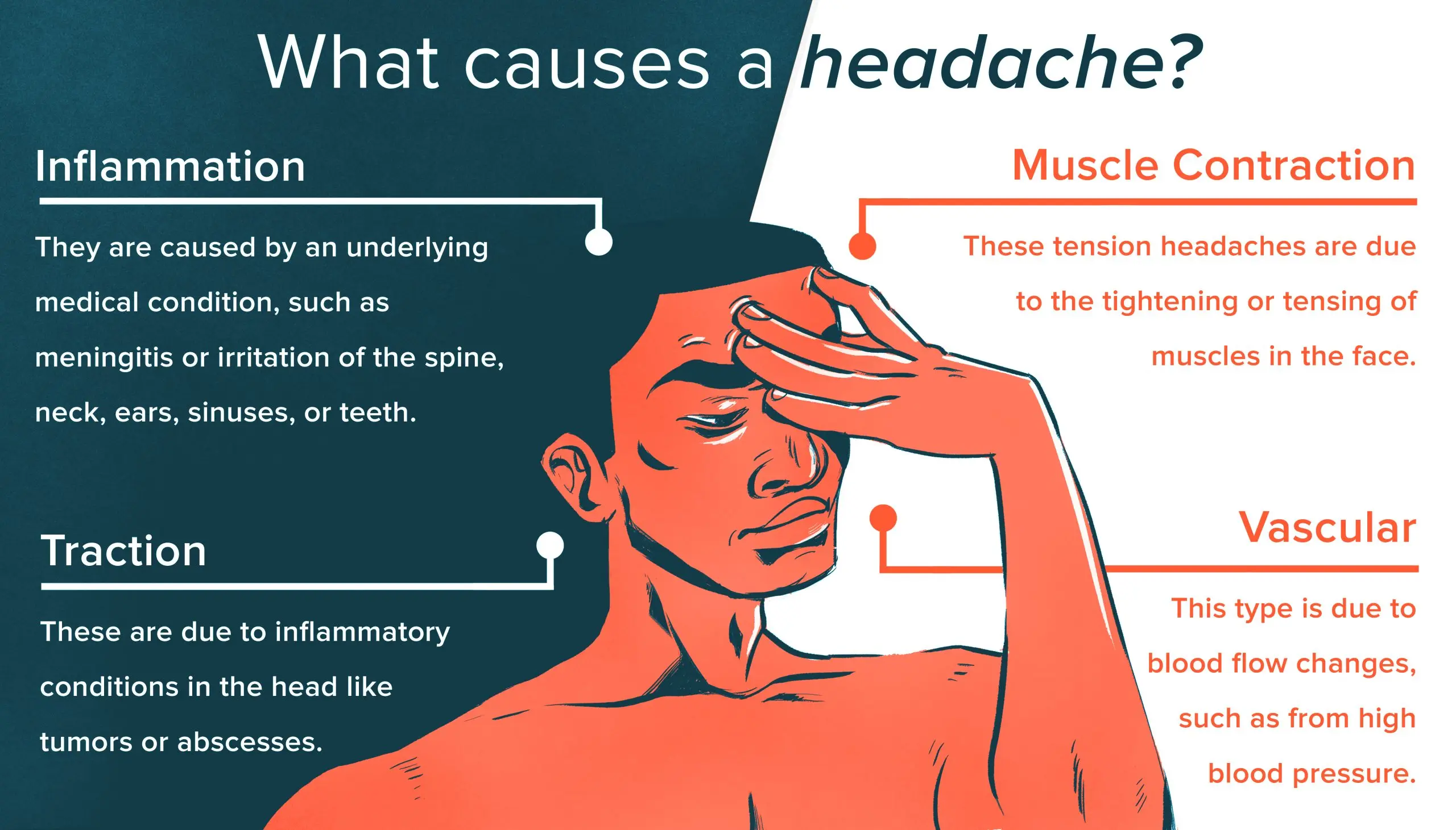 Remedies for a headache &#8211; causes of discomfort. How to deal with headache with home remedies? [WE EXPLAIN]