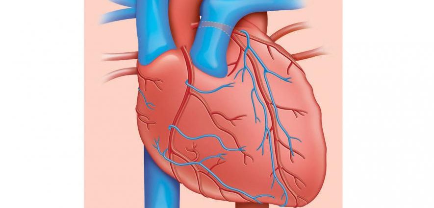 Researchers are working on a drug that will protect tissue after stroke and heart attack