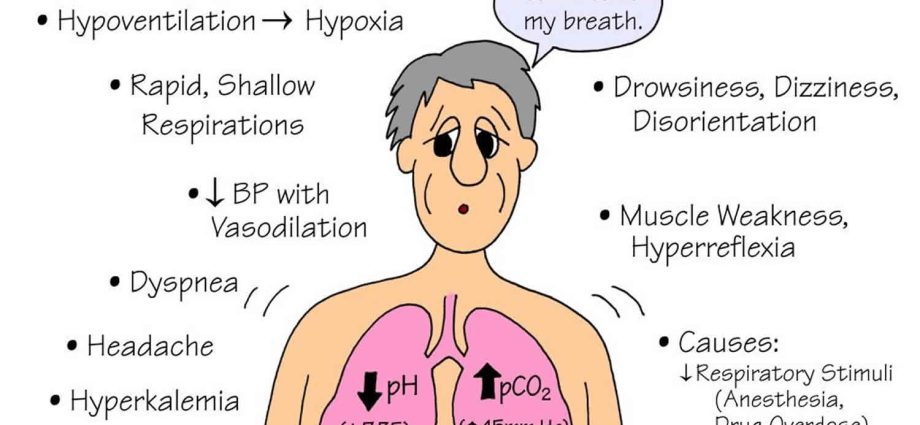 Respiratory acidosis &#8211; causes, symptoms, treatment