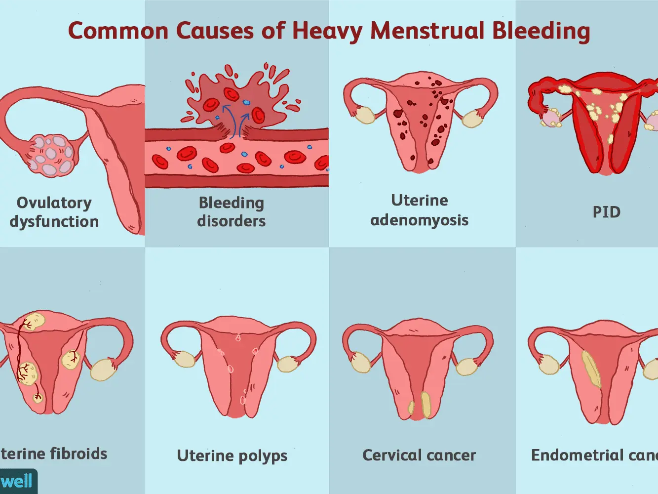 Reticulation of the uterus &#8211; symptoms, causes and effects on pregnancy. Does it heal? WE EXPLAIN