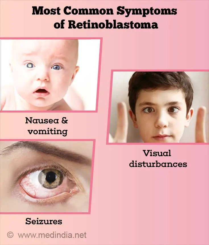 Retinoblastoma &#8211; symptoms and treatment of dangerous eye cancer in children