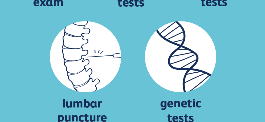 Rett syndrome &#8211; causes, symptoms, diagnosis, treatment, prognosis