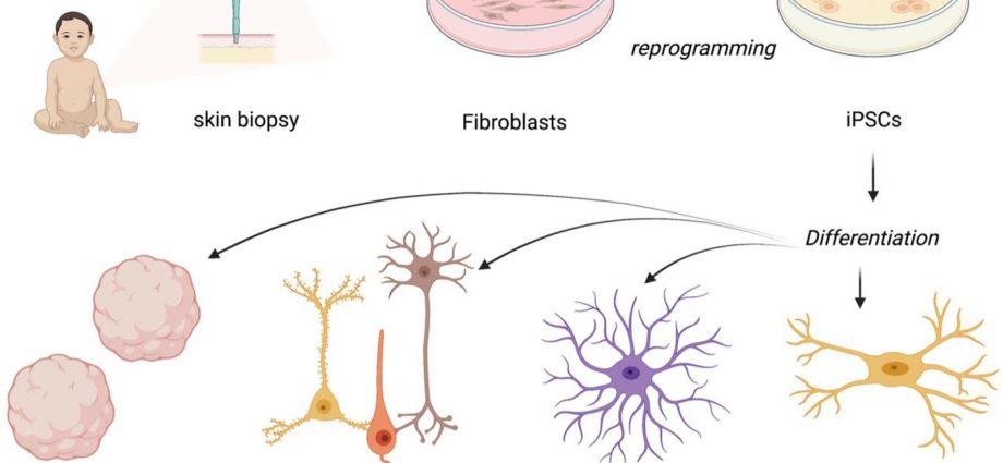 Rett syndrome has to do with moving parts of the DNA