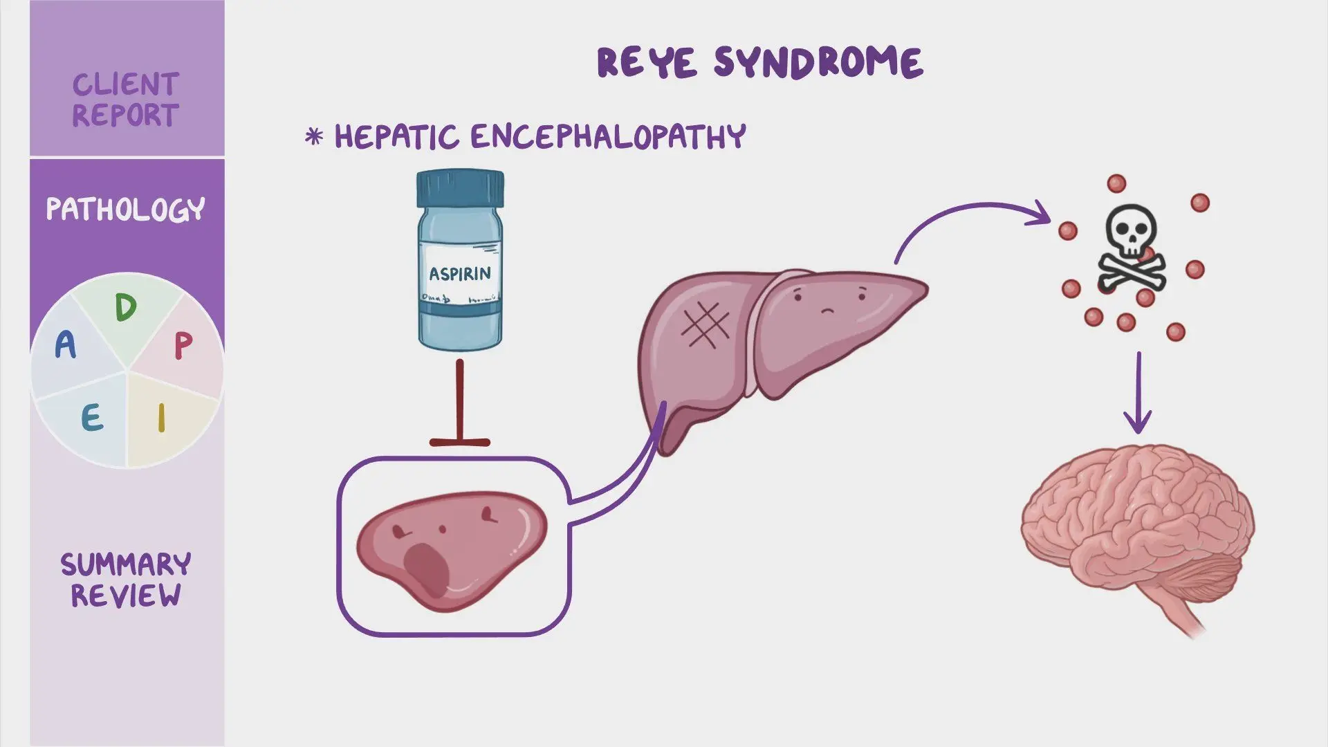 Reye&#8217;s syndrome &#8211; causes, diagnostics, intensive treatment, how to reduce the risk