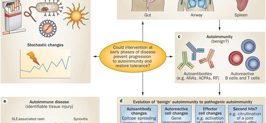 Rheumatic profile, i.e. what tests will help detect rheumatic diseases