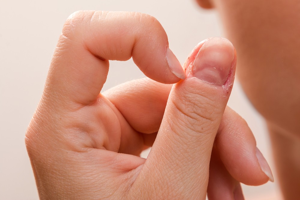 Rod-shaped fingers are an unusual symptom of lung cancer and liver disease. Pay attention to the shape of the nails