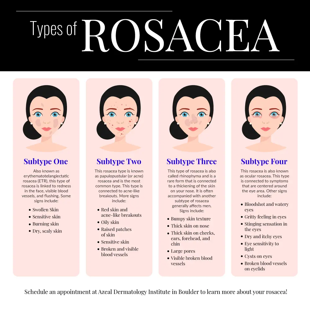 Rosacea &#8211; the main symptoms. How To Treat Rosacea?