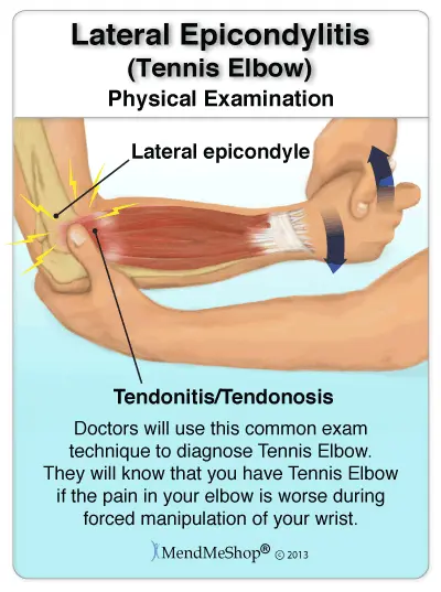 Rose, rubella, tennis elbow &#8211; will you recognize the disease by its name? Check yourself!