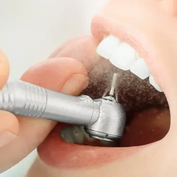 Sandblasting and the teeth whitening effect, or how to effectively remove discoloration