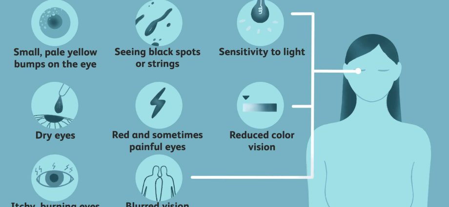 Sarcoidosis &#8211; causes, symptoms, diagnosis, complications. How is sarcoidosis treated?