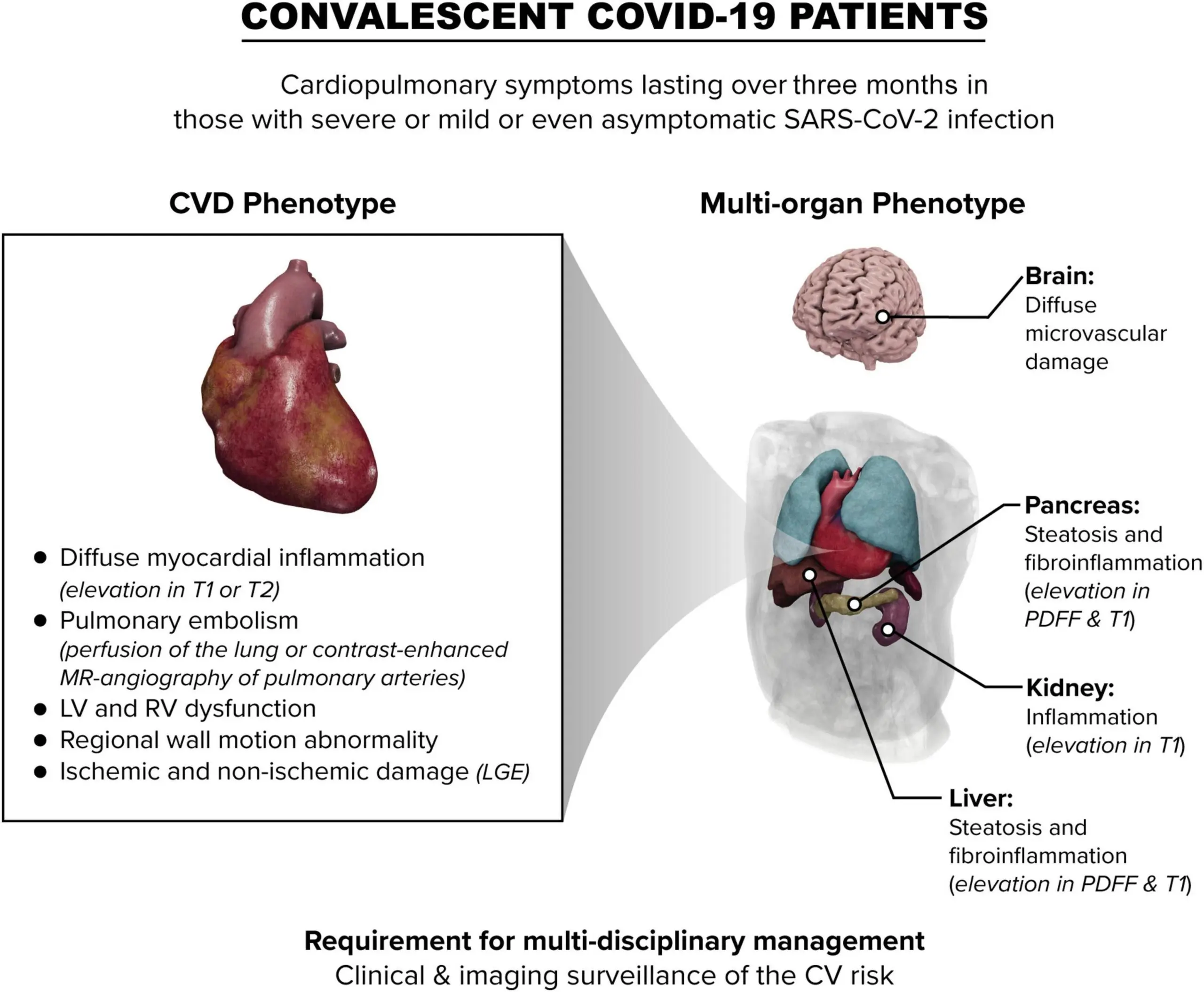 SARS-CoV-2 coronavirus infection can damage heart even in people with mild COVID-19 symptoms