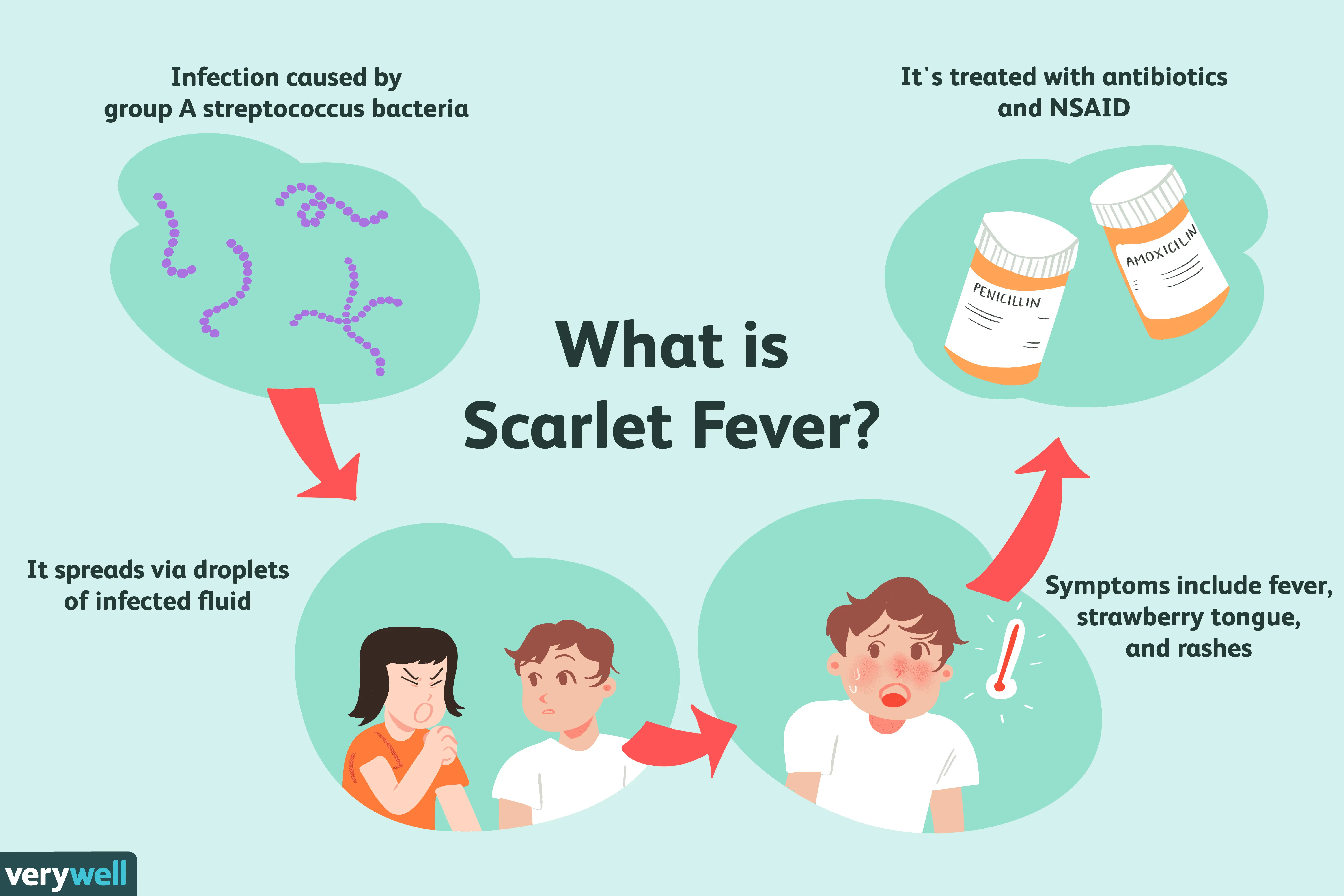 Scarlet fever in adults &#8211; symptoms and treatment. Complications after scarlet fever