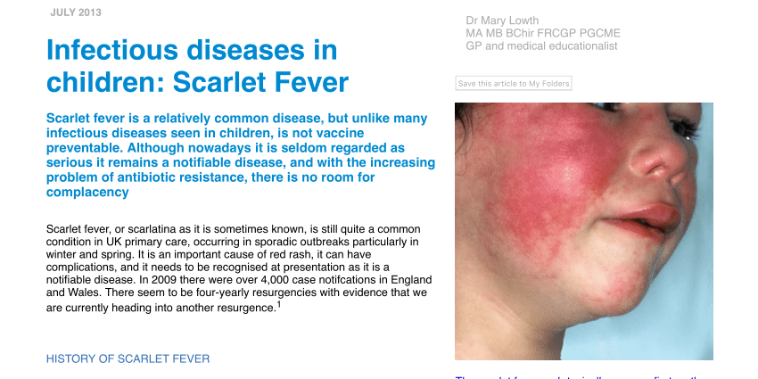 Scarlet fever in children &#8211; characteristics, symptoms, complications