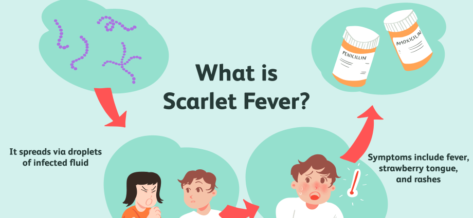 Scarlet fever &#8211; symptoms, diagnosis, treatment, complications