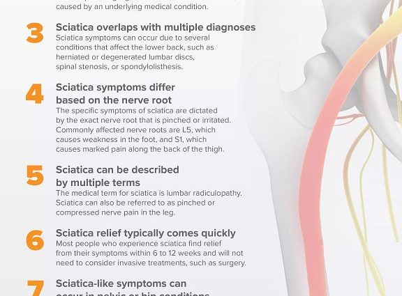 Sciatica &#8211; Which Exercises Will Help Heal? Sciatica causes and symptoms