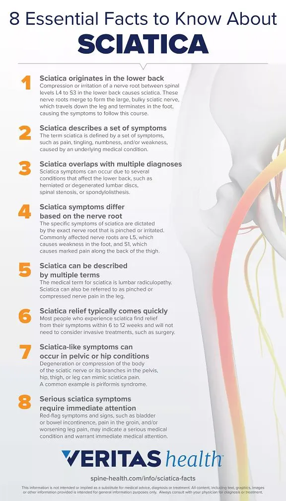 Sciatica &#8211; Which Exercises Will Help Heal? Sciatica causes and symptoms