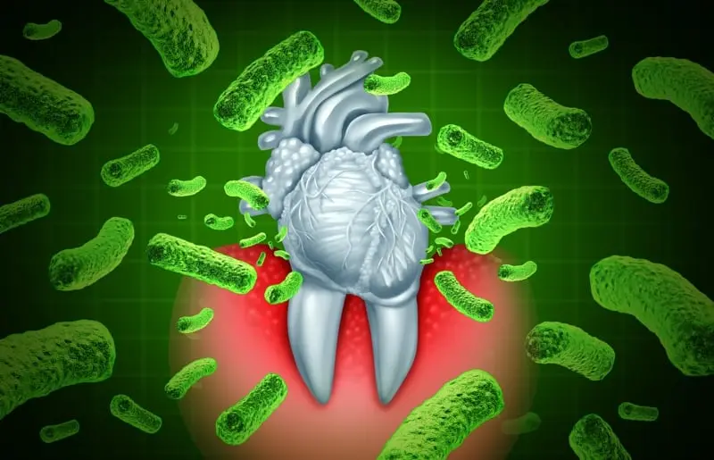 Scientists explain the link between gum disease and heart disease