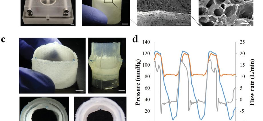 Scientists from Bydgoszcz have developed an artificial hand. The denture will be 3D printed