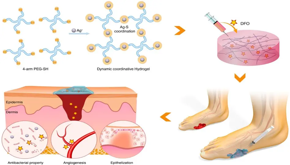 Scientists from Lodz have developed a hydrogel dressing for the treatment of diabetic wounds