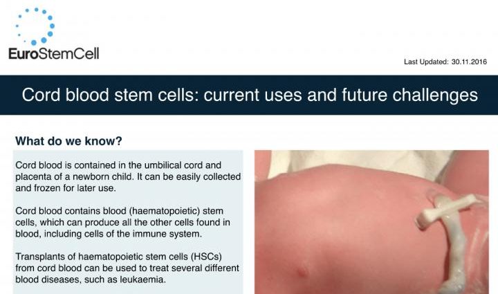 Scientists on the prospects of medical use of umbilical cord blood